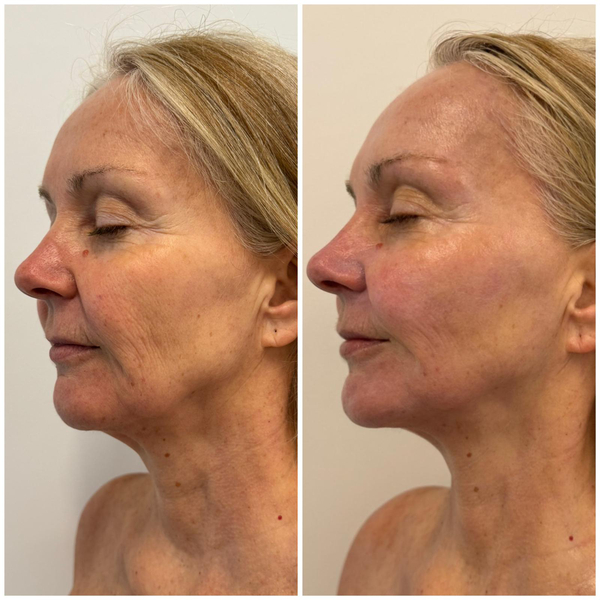 Cover photo of Simply Beauty of Chiswick - beauty salon in Chiswick